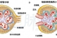 常见糖尿病并发症筛查有哪些？