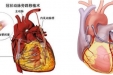 【特色技术】冠状动脉搭桥术