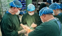 运动医学科：重塑膝关节健康——固定平台膝关节单髁置换术