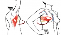 美好“乳”初，重拾自信——乳腺癌术后乳房重建术