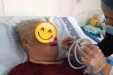 神经康复科：导管球囊扩张术帮您摆脱吞咽障碍